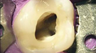 ENDODONZIA
